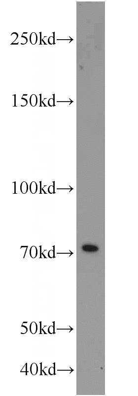 mouse kidney tissue were subjected to SDS PAGE followed by western blot with Catalog No:111333(HADHA antibody) at dilution of 1:1000