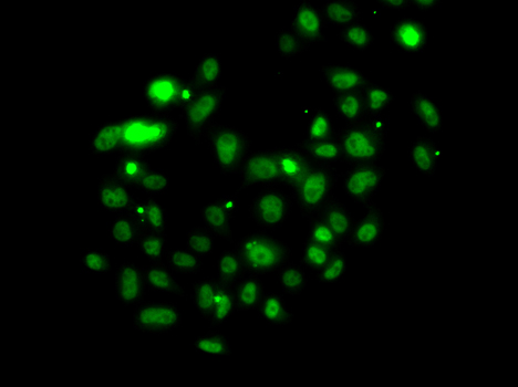 Immunofluorescence - PMS2 Polyclonal Antibody 