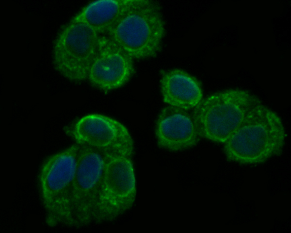 Fig2: ICC staining PHF8 in Hela cells (green). The nuclear counter stain is DAPI (blue). Cells were fixed in paraformaldehyde, permeabilised with 0.25% Triton X100/PBS.