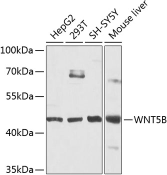 Western blot - WNT5B Polyclonal Antibody 