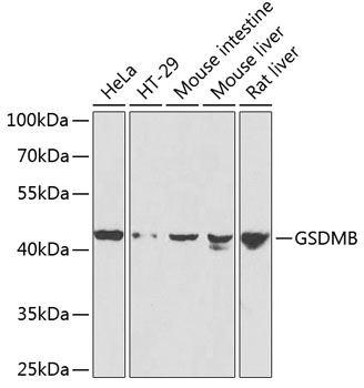 Western blot - GSDMB Polyclonal Antibody 