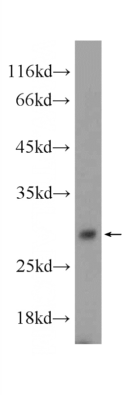 mouse testis tissue were subjected to SDS PAGE followed by western blot with Catalog No:115994(C1orf223 Antibody) at dilution of 1:600