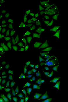 Immunofluorescence - AIPL1 Polyclonal Antibody 