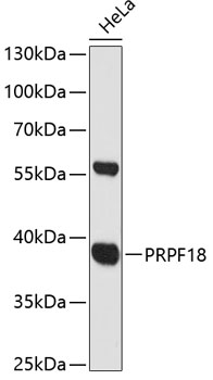 Western blot - PRPF18 Polyclonal Antibody 