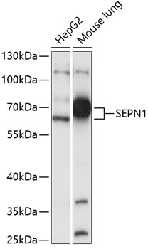 Western blot - SEPN1 Polyclonal Antibody 