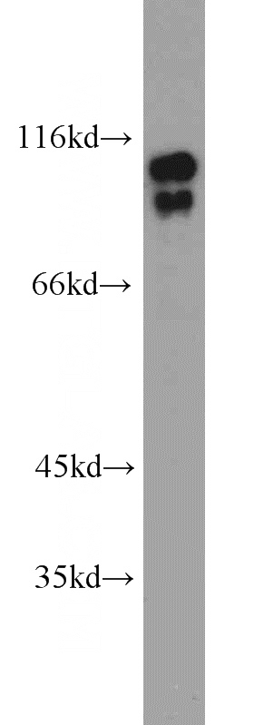 HEK-293 cells were subjected to SDS PAGE followed by western blot with Catalog No:116585(USP1 antibody) at dilution of 1:300