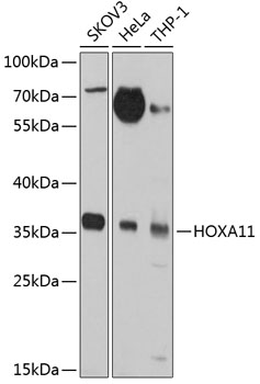 Western blot - HOXA11 Polyclonal Antibody 