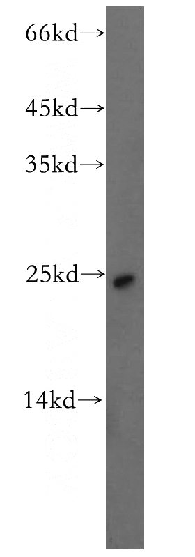 human placenta tissue were subjected to SDS PAGE followed by western blot with Catalog No:117192(BMF antibody) at dilution of 1:300