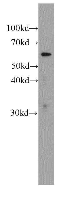 HepG2 cells were subjected to SDS PAGE followed by western blot with Catalog No:107467(PGM1 antibody) at dilution of 1:1000
