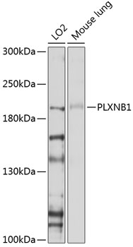 Western blot - PLXNB1 Polyclonal Antibody 