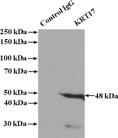 IP Result of anti-KRT17 (IP:Catalog No:109796, 4ug; Detection:Catalog No:109796 1:600) with HeLa cells lysate 1600ug.