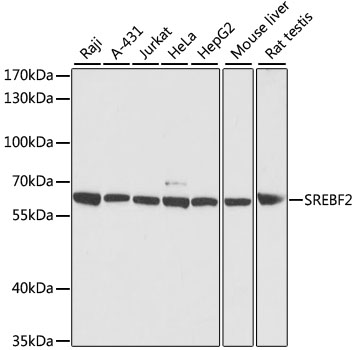 Western blot - SREBF2 Polyclonal Antibody 