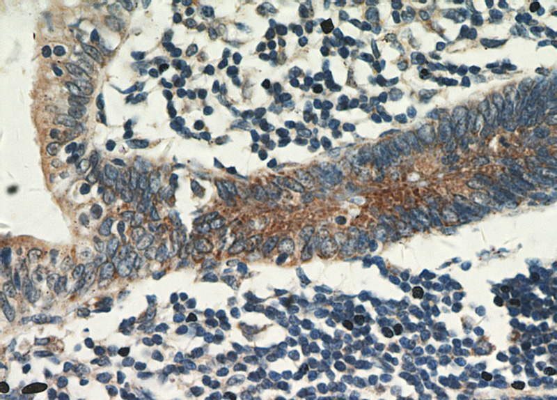 Immunohistochemical of paraffin-embedded human colon using Catalog No:108992(CCDC93 antibody) at dilution of 1:100 (under 40x lens)