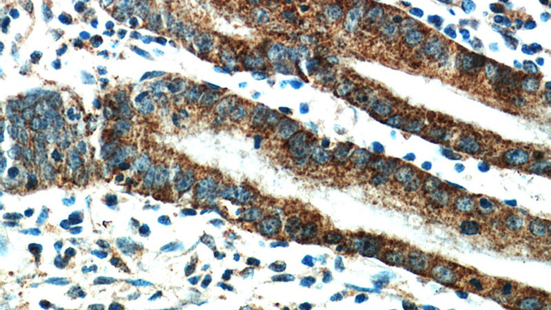 Immunohistochemical of paraffin-embedded human stomach using Catalog No:111447(HPDL antibody) at dilution of 1:50 (under 40x lens)