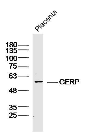 Fig1: Sample:; Placenta (Mouse) Lysate at 40 ug; Primary: Anti- GERP at 1/300 dilution; Secondary: IRDye800CW Goat Anti-Rabbit IgG at 1/20000 dilution; Predicted band size: 61kD; Observed band size: 61kD