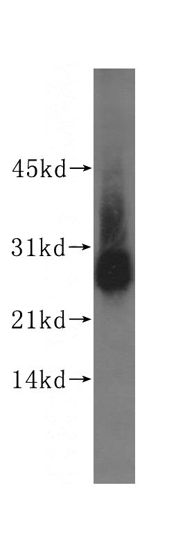 A549 cells were subjected to SDS PAGE followed by western blot with Catalog No:116671(UCHL1 antibody) at dilution of 1:400