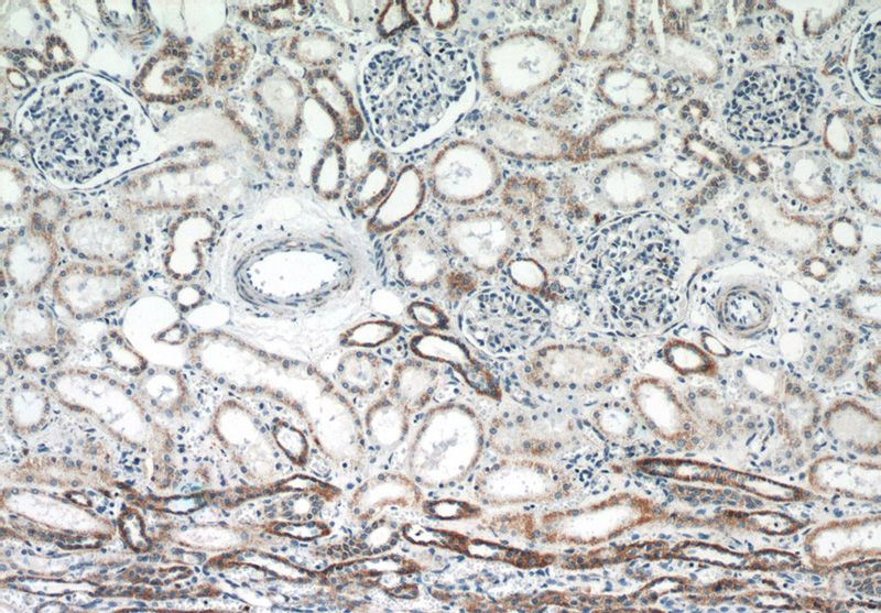 Immunohistochemistry of paraffin-embedded human kidney slide using Catalog No:115995(TFAM Antibody) at dilution of 1:50