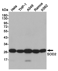 Western blot detection of SOD2 in Hela,THP-1,A549 Ramos and K562 cell lysates using SOD2 Mouse mAb (1:1000 diluted). Predicted band size: 25KDa. Observed band size:22KDa.