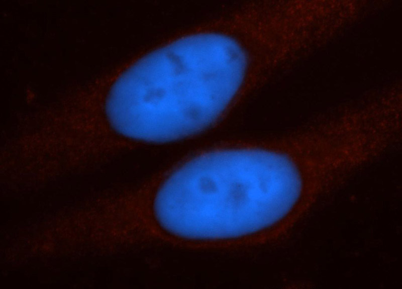 Immunofluorescent analysis of HepG2 cells, using TPP2 antibody Catalog No:116210 at 1:50 dilution and Rhodamine-labeled goat anti-rabbit IgG (red). Blue pseudocolor = DAPI (fluorescent DNA dye).
