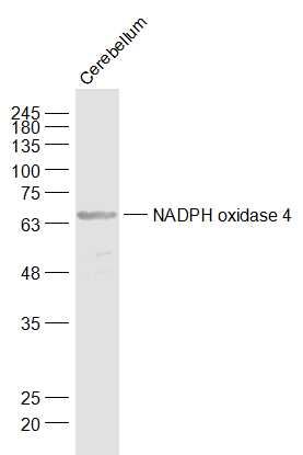 Fig6: Sample:; Cerebellum (Mouse) Lysate at 40 ug; Primary: Anti-NADPH oxidase 4 at 1/1000 dilution; Secondary: IRDye800CW Goat Anti-Rabbit IgG at 1/20000 dilution; Predicted band size: 64 kD; Observed band size: 64 kD