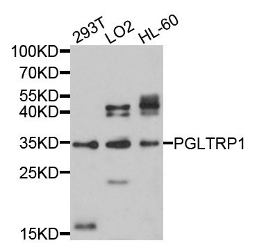 Western blot - PGLYRP1 Polyclonal Antibody 
