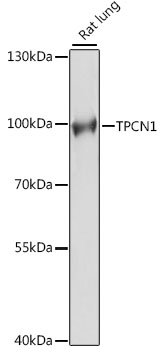 Western blot - TPCN1 Polyclonal Antibody 