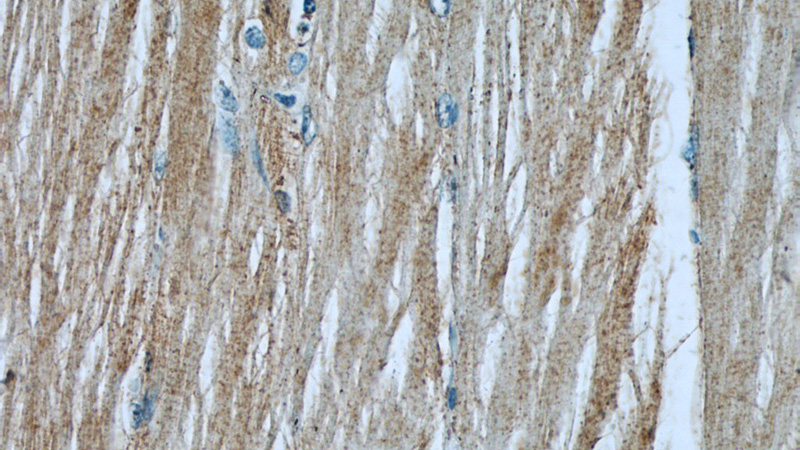 Immunohistochemistry of paraffin-embedded human skeletal muscle slide using Catalog No:112341(LRSAM1 Antibody) at dilution of 1:50