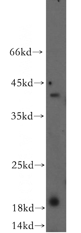 human brain tissue were subjected to SDS PAGE followed by western blot with Catalog No:110372(TXNDC12 antibody) at dilution of 1:500
