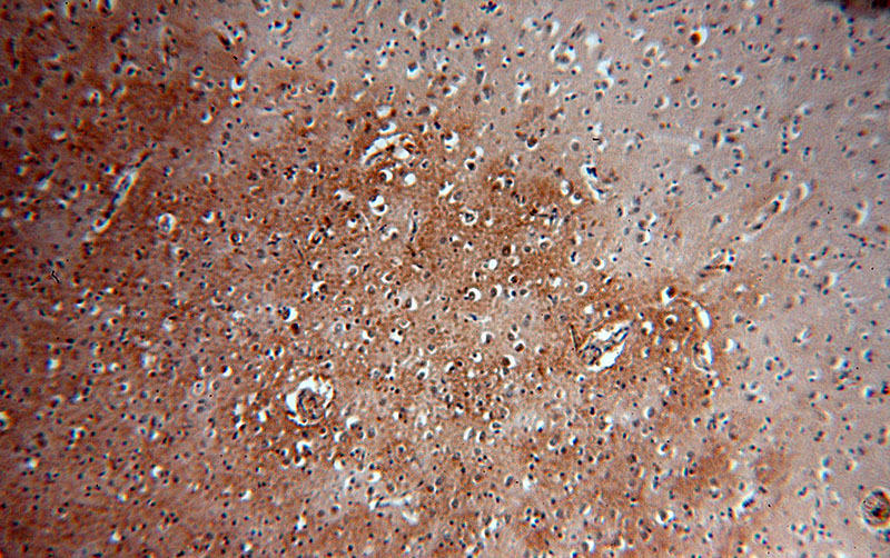 Immunohistochemical of paraffin-embedded human brain using Catalog No:113949(PLCH1 antibody) at dilution of 1:50 (under 10x lens)