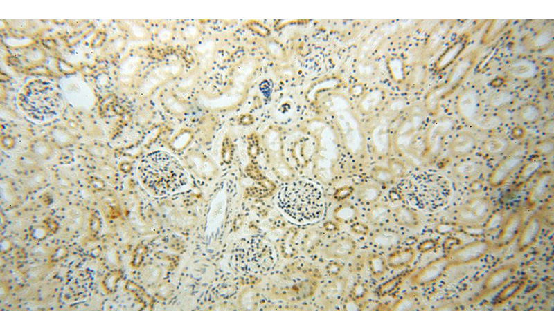 Immunohistochemical of paraffin-embedded human kidney using Catalog No:113014(NADK antibody) at dilution of 1:50 (under 10x lens)