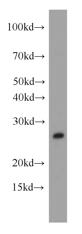 human brain tissue were subjected to SDS PAGE followed by western blot with Catalog No:113487(PAFAH1B3 antibody) at dilution of 1:500