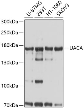 Western blot - UACA Polyclonal Antibody 