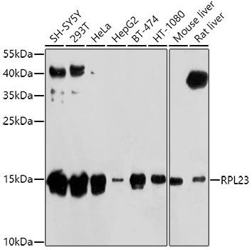 Western blot - RPL23 Polyclonal Antibody 