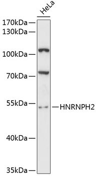 Western blot - HNRNPH2 Polyclonal Antibody 
