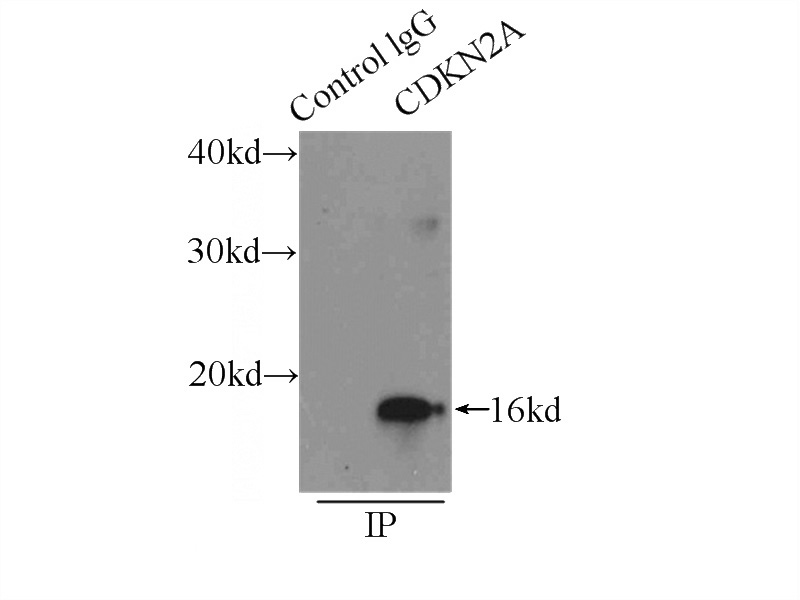 IP Result of anti-P16 (IP:Catalog No:113538, 4ug; Detection:Catalog No:113538 1:1000) with HEK-293 cells lysate 4500ug.