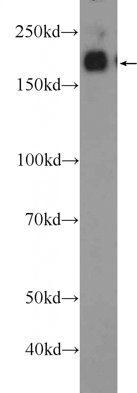 mouse liver tissue were subjected to SDS PAGE followed by western blot with Catalog No:109125(CD45 Antibody) at dilution of 1:300