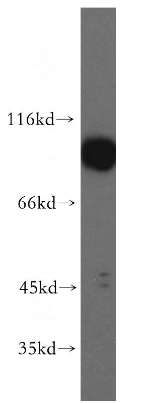 human brain tissue were subjected to SDS PAGE followed by western blot with Catalog No:108041(APPL1 antibody) at dilution of 1:500
