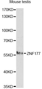Western blot - ZNF177 Polyclonal Antibody 