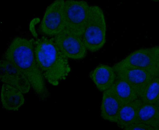 Fig3:; ICC staining of Factor H in HepG2 cells (green). Formalin fixed cells were permeabilized with 0.1% Triton X-100 in TBS for 10 minutes at room temperature and blocked with 1% Blocker BSA for 15 minutes at room temperature. Cells were probed with the primary antibody ( 1/50) for 1 hour at room temperature, washed with PBS. Alexa Fluor®488 Goat anti-Rabbit IgG was used as the secondary antibody at 1/1,000 dilution. The nuclear counter stain is DAPI (blue).