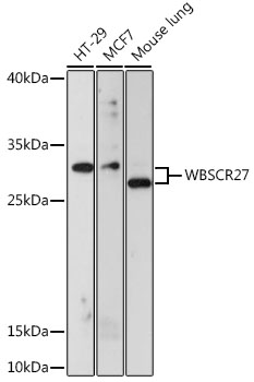 Western blot - WBSCR27 Polyclonal Antibody 