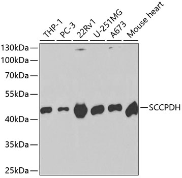 Western blot - SCCPDH Polyclonal Antibody 