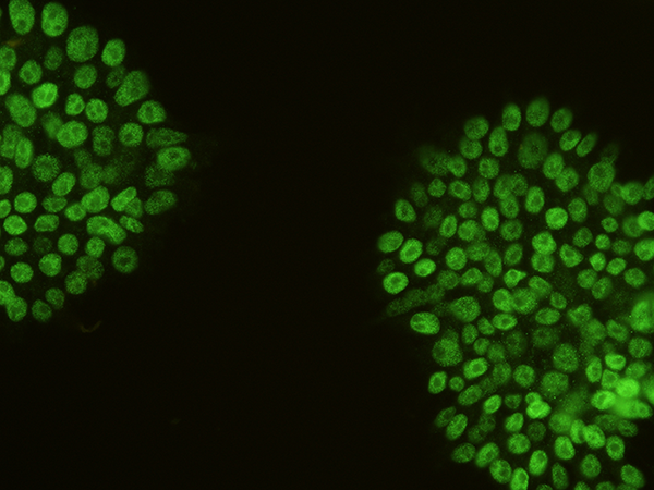 Nanog Antibody, Rabbit PAb, Antigen Affinity Purified, Immunofluorescence