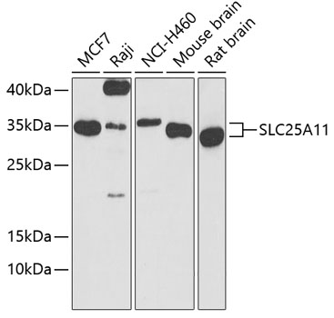 Western blot - SLC25A11 Polyclonal Antibody 