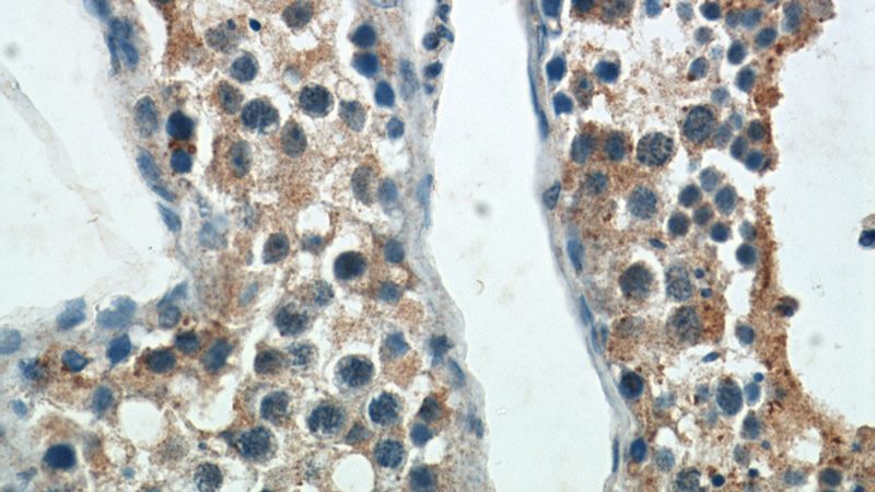 Immunohistochemical of paraffin-embedded human testis using Catalog No:115624(ST3GAL4 antibody) at dilution of 1:50 (under 40x lens)