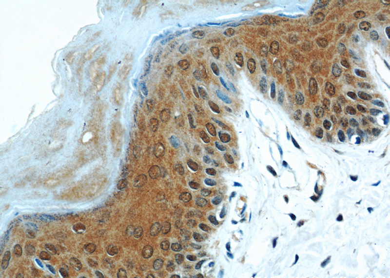 Immunohistochemical of paraffin-embedded human skin using Catalog No:107518(S100A11 antibody) at dilution of 1:50 (under 40x lens)