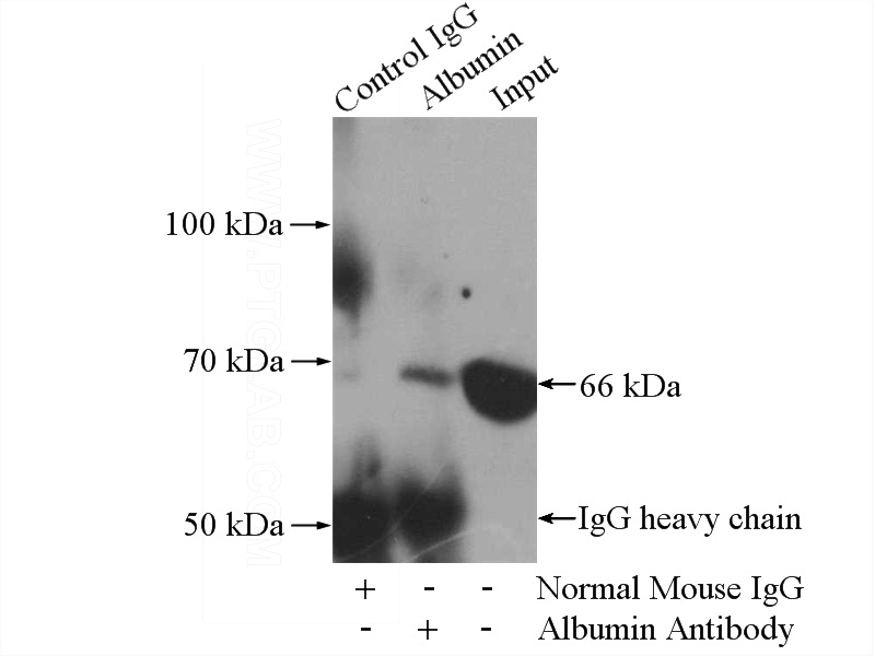 IP Result of anti-Albumin (IP:Catalog No:107569, 5ug; Detection:Catalog No:107569 1:5000) with HepG2 cells lysate 1800ug.