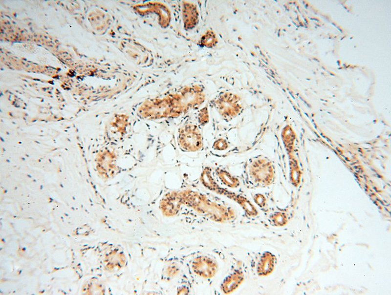 Immunohistochemical of paraffin-embedded human skin using Catalog No:114102(PPP2R3A antibody) at dilution of 1:100 (under 10x lens)