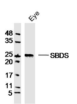 Fig1: Sample:Eye (Mouse)Lysate at 40 ug; Primary: Anti-GCAP1 at 1/300 dilution; Secondary: IRDye800CW Goat Anti-RabbitIgG at 1/20000 dilution; Predicted band size: 23kD; Observed band size: 25kD