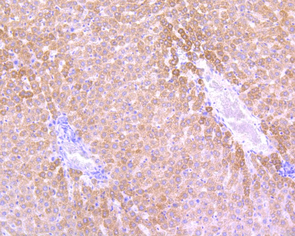 Fig8:; Immunohistochemical analysis of paraffin-embedded rat liver tissue using anti-Sonic Hedgehog Protein antibody. Counter stained with hematoxylin.