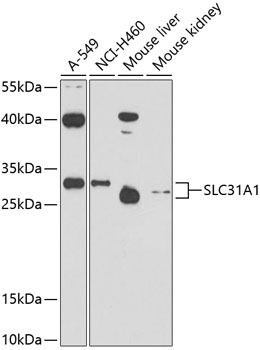 Western blot - SLC31A1 Polyclonal Antibody 